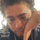 Whindersson Nunes vem a publico e revela que perdeu fortuna