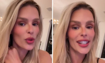 Yasmin Brunet revela que descobriu lipedema de forma inusitada.webp