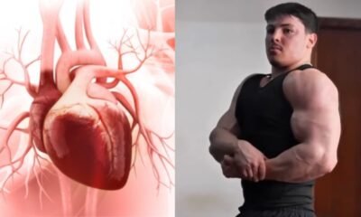 o que e e quais sao os sintomas da doenca