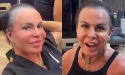 ‘Constrangedor Gretchen faz desabafo sobre seu visual enquanto enfrenta doenca