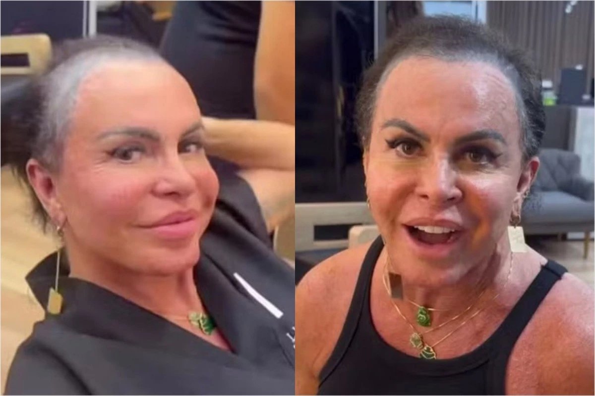 ‘Constrangedor Gretchen faz desabafo sobre seu visual enquanto enfrenta doenca