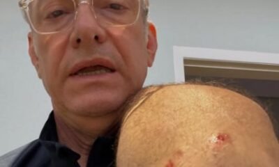 Ancora da Globo e atacado por pitbull em SP e