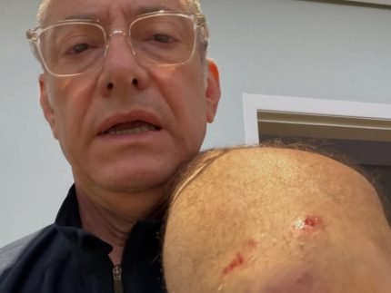 Ancora da Globo e atacado por pitbull em SP e