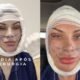 Andressa Urach revela antes e depois de transformacao facial veja