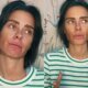 Apos descobrir doenca em estagio avancado Carolina Dieckmann revela sintomas