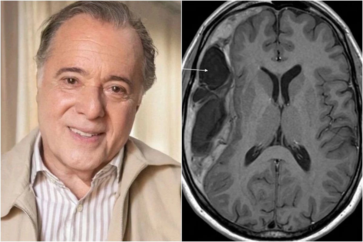 Doenca que foi diagnosticada em Tony Ramos e silenciosa pode