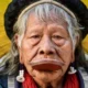 Dois dias apos cirurgia Cacique Raoni segue estavel na.webp