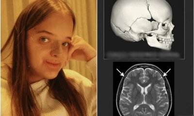 Esta e a condicao de saude diagnosticada em Rafa Justus