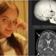 Esta e a condicao de saude diagnosticada em Rafa Justus