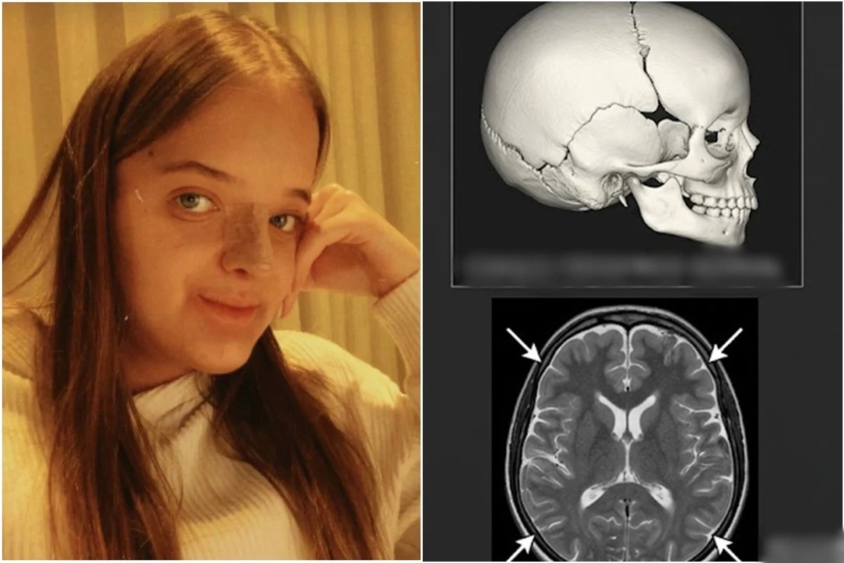 Esta e a condicao de saude diagnosticada em Rafa Justus