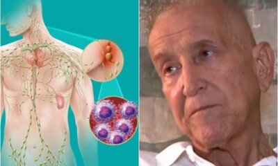Este e o cancer que foi diagnosticado em Carlos Alberto