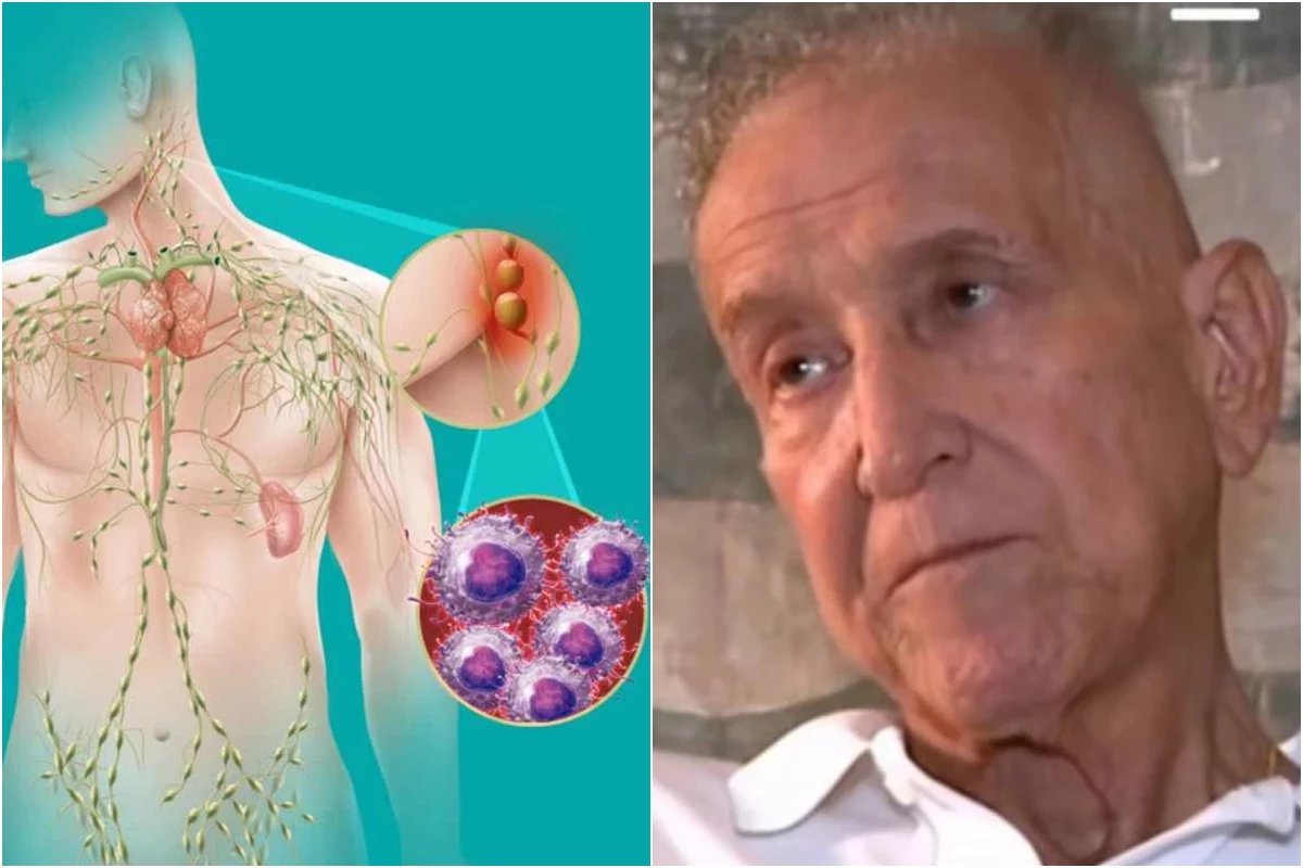 Este e o cancer que foi diagnosticado em Carlos Alberto