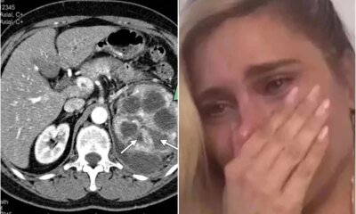 Este e o problema de saude diagnosticado em Carolina Dieckmmann