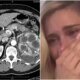Este e o problema de saude diagnosticado em Carolina Dieckmmann