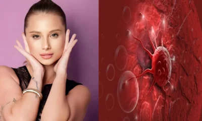 Famosa atriz da Globo revela diagnostico de cancer de.webp