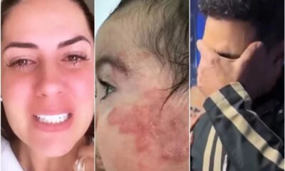 Filha de Zeze e Graciele seguira em acompanhamento medico apos