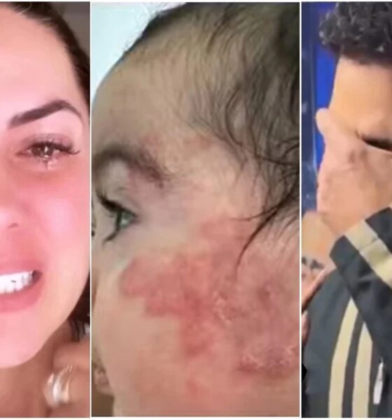 Filha de Zeze e Graciele seguira em acompanhamento medico apos