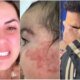 Filha de Zeze e Graciele seguira em acompanhamento medico apos