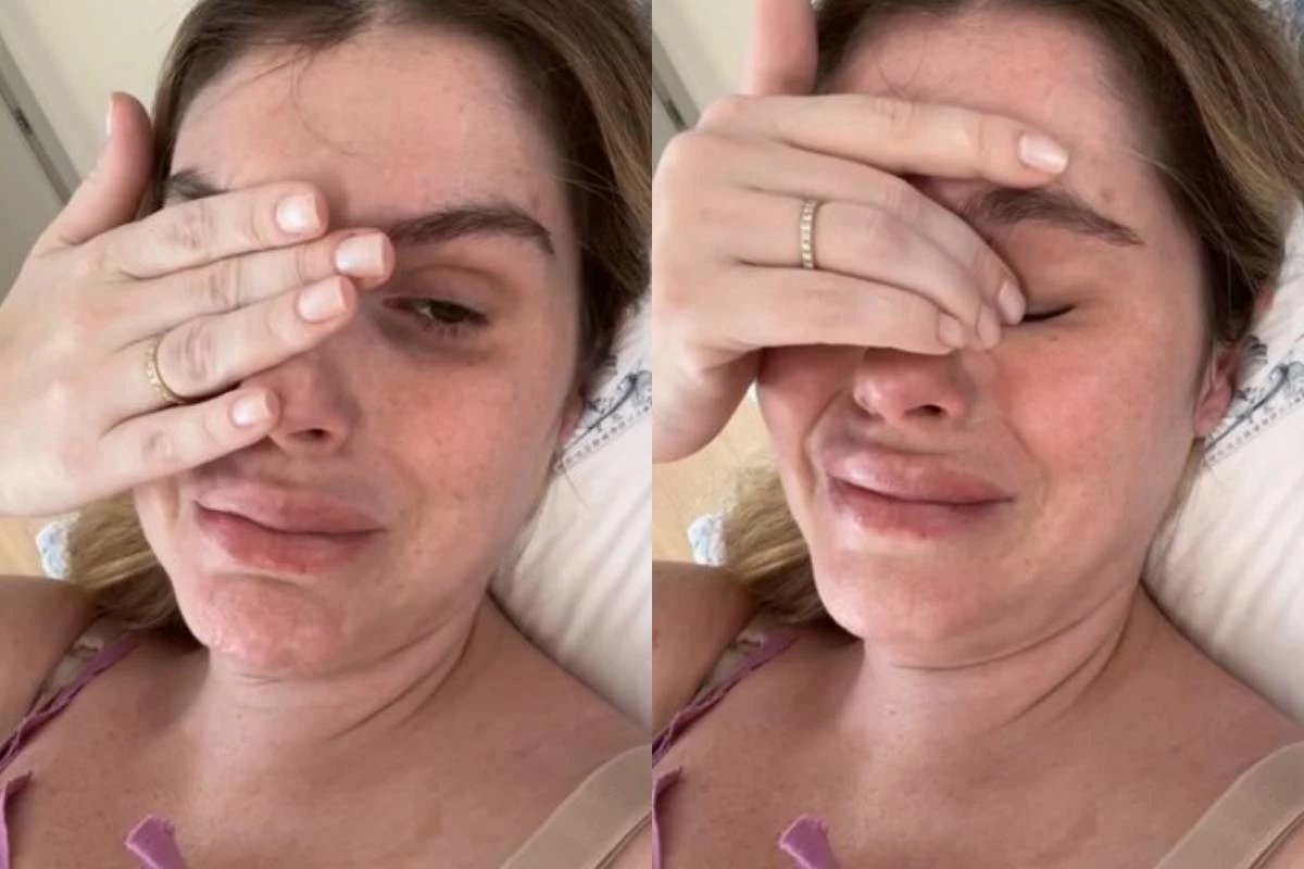Filho de Barbara Evans sofre acidente domestico leva ponto na
