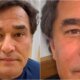 Foi assim que Luciano Szafir ficou depois da harmonizacao facial