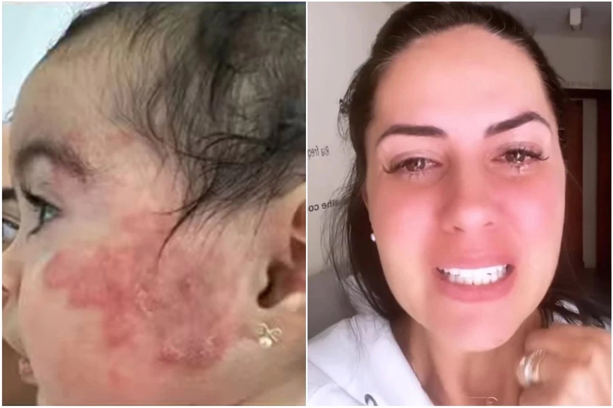 Foi isso que teria causado surgimento de nodulos na filha