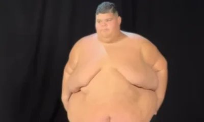 Gordao da XJ emagrece 130 kg e mostra antes.webp