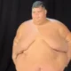 Gordao da XJ emagrece 130 kg e mostra antes.webp