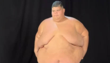 Gordao da XJ emagrece 130 kg e mostra antes.webp