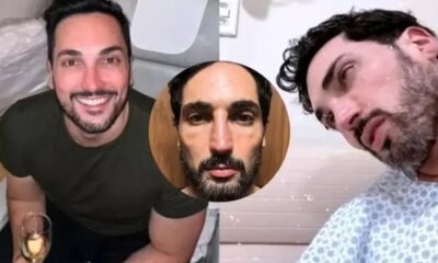 Influencer aparece com rosto derretido apos uso de Monjauro e