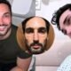 Influencer aparece com rosto derretido apos uso de Monjauro e