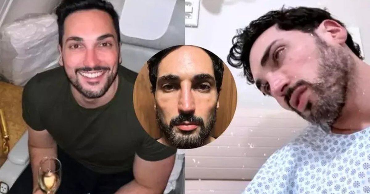 Influencer aparece com rosto derretido apos uso de Monjauro e