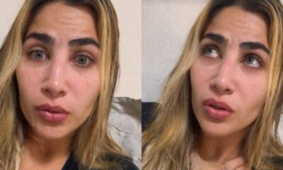 Jessica Beatriz filha de Leonardo sofre acidente domestico e relata