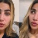 Jessica Beatriz filha de Leonardo sofre acidente domestico e relata