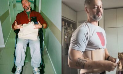 Lucas lima surge em cadeira de rodas e estado de