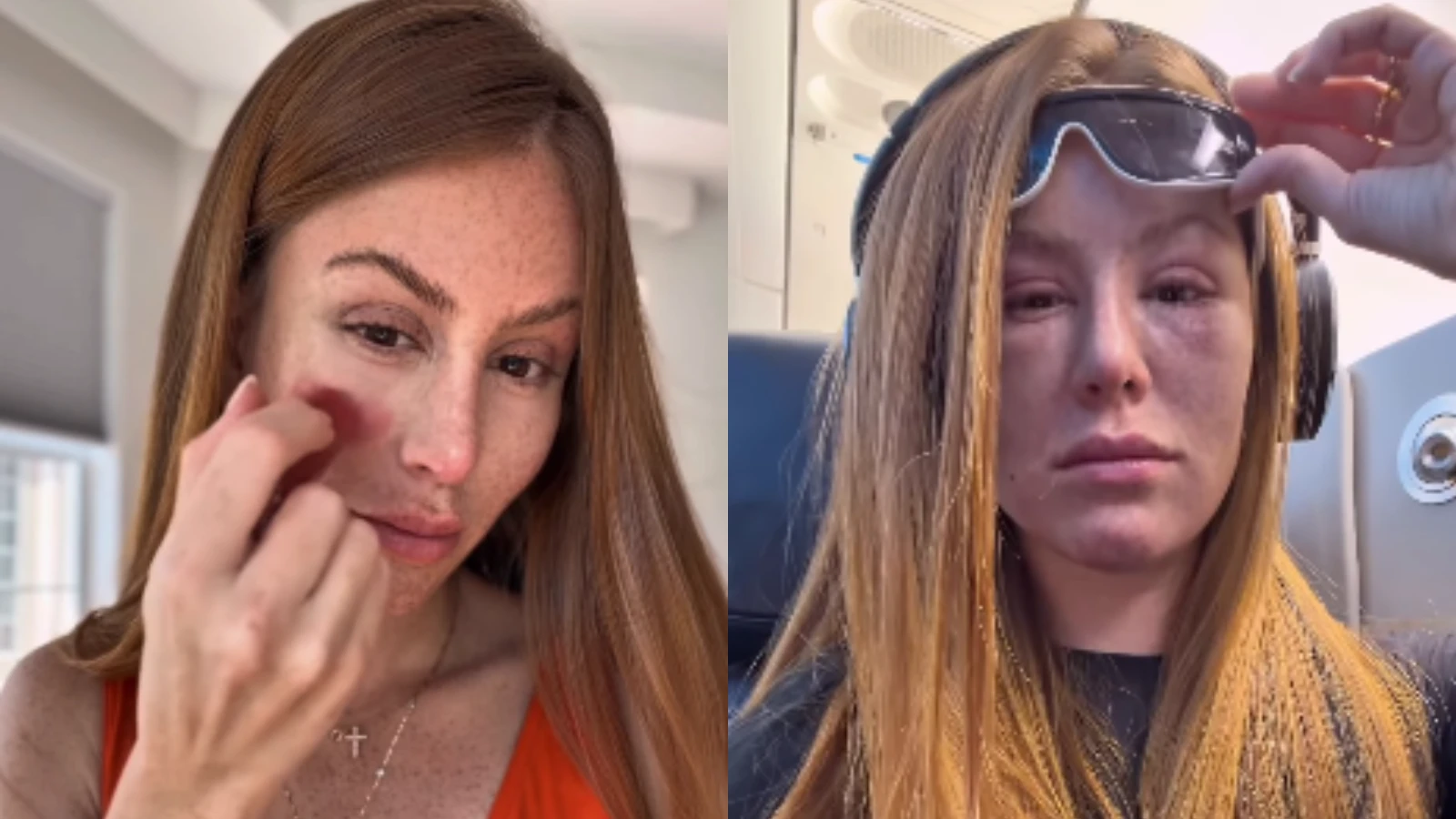 Mari Maria usa laser para tratar tumores nos olhos.webp