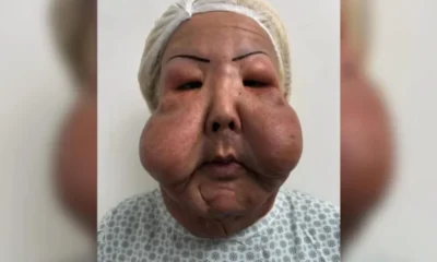Veja como esta Juju do Pix seis meses depois.webp