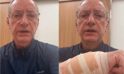 Video jornalista da Globo e atacado por pitbulll e fica