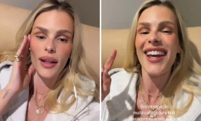 Yasmin Brunet relata crise de lipedema apos comer gluten.webp