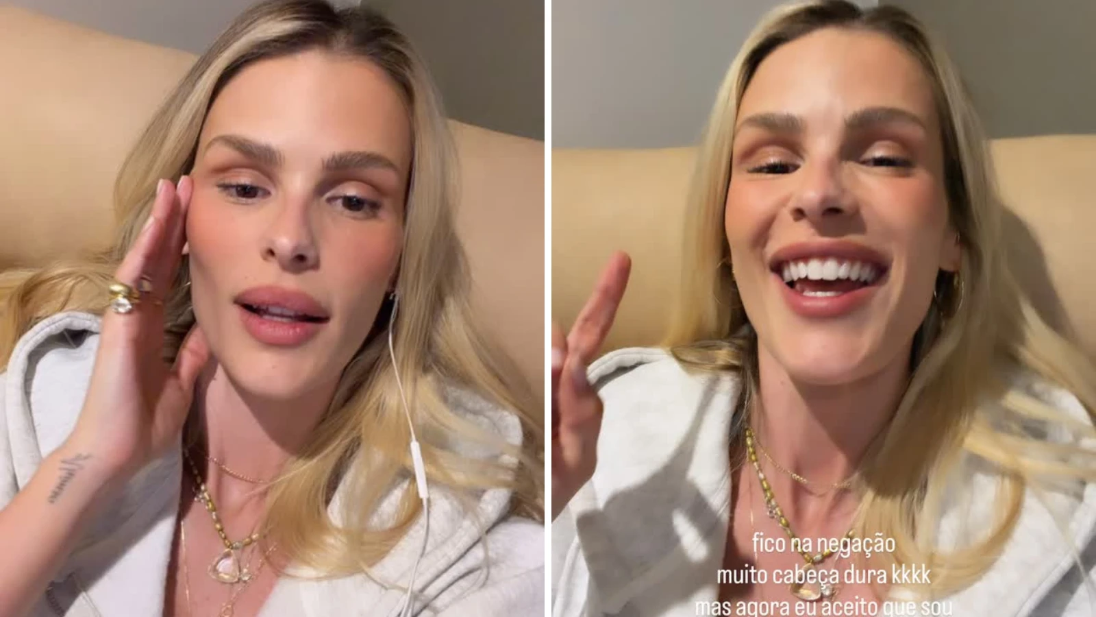 Yasmin Brunet relata crise de lipedema apos comer gluten.webp