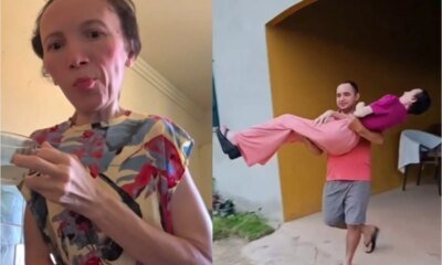 ‘Estatua viva influenciadora luta contra doenca sem cura