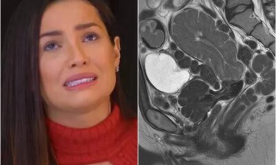 Esta e a doenca diagnosticada em Juliette e ela se
