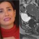 Esta e a doenca diagnosticada em Juliette e ela se