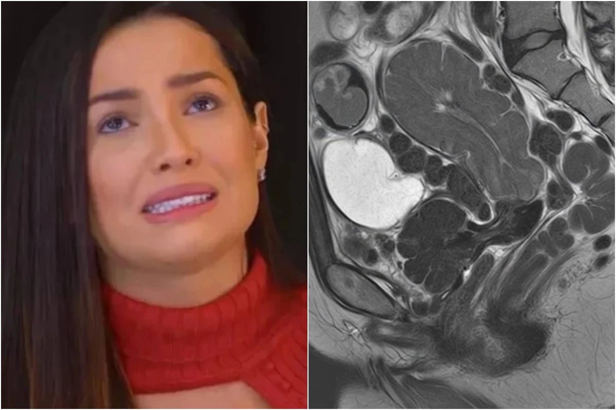 Esta e a doenca diagnosticada em Juliette e ela se