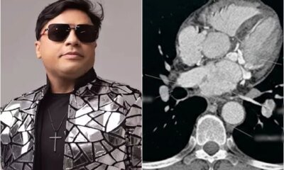Esta foi a causa da morte do cantor Neto Araujo