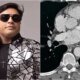 Esta foi a causa da morte do cantor Neto Araujo