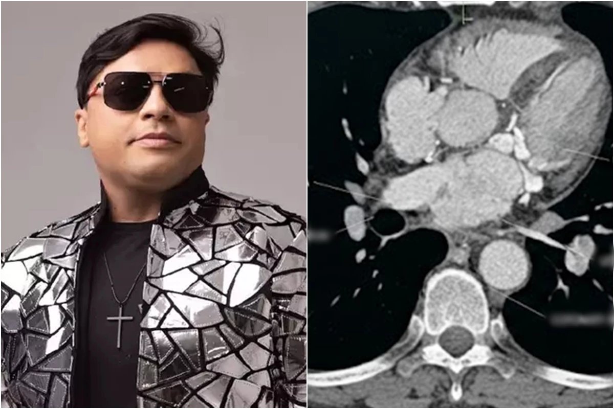 Esta foi a causa da morte do cantor Neto Araujo