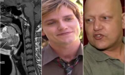 Este era o cancer que ator Edward Boggiss enfrentava antes