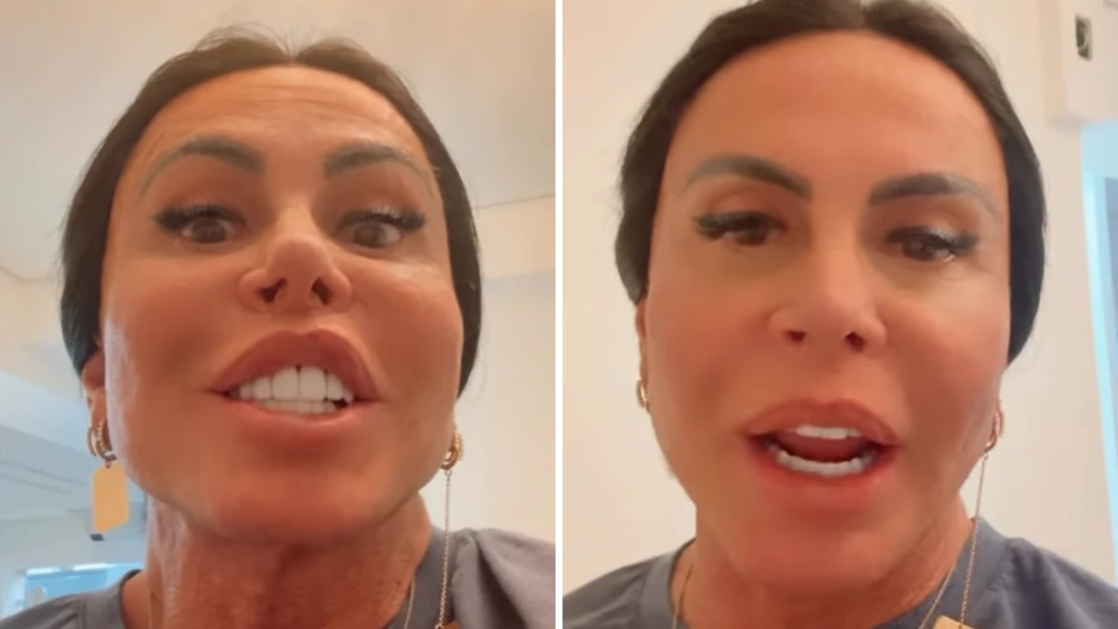 Gretchen rebate criticas sobre procedimento Meu marido gosta.webp