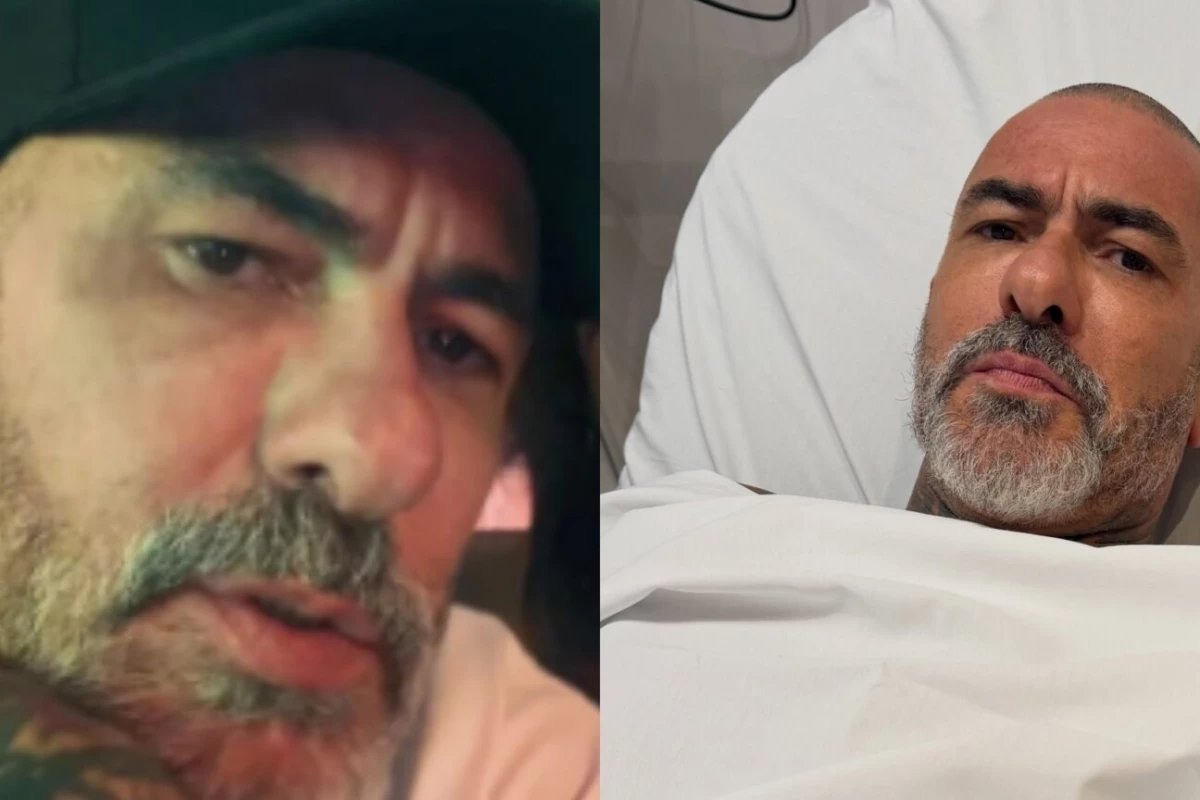 Henrique Fogaca exibe imagens apos acidente relata lesoes e diz