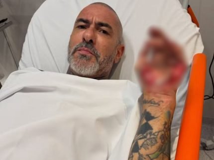 Henrique Fogaca expoe feridas de acidente e revela roubo de